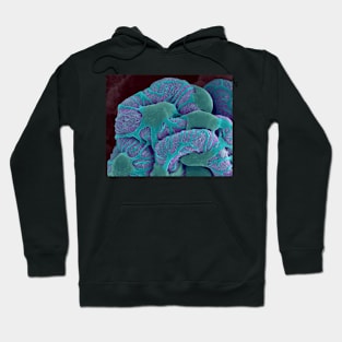 Kidney glomerulus, SEM (C031/9778) Hoodie